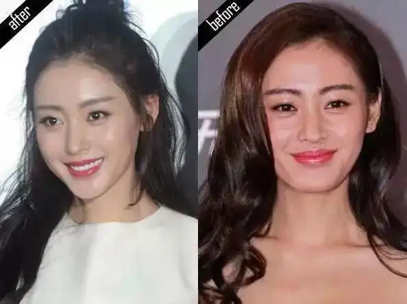 修饰好发际线就等于换了张脸,不信你看

