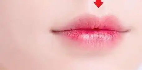 嘴唇上有这一点的女生,颜值普遍不会低很少女生才会有
