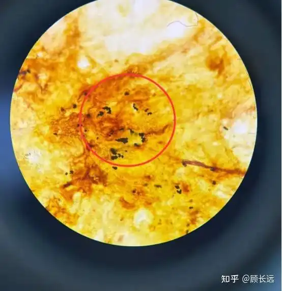 头发特别容易油,有好的方法么
