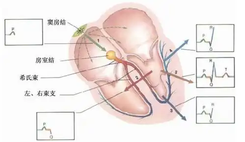 什么是心律失常
